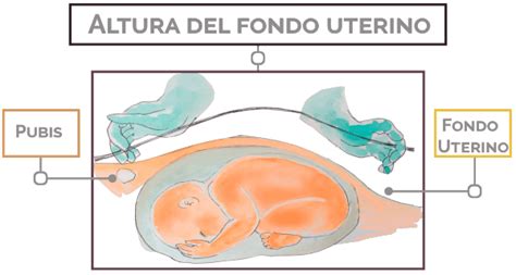 fondo uterino